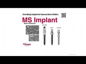 Hiossen MS Implant: A One-Body Implant Solution for Narrow Ridge Cases
