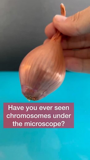 Biology on Instagram: "🔬 Observing Chromosomes in Onion Cells Under a Microscope. Onion (Allium cepa) root tips are commonly used in biology labs to study mitosis, the process of cell division. This is because the root tip is a region of active growth, where cells are rapidly dividing, making it easier to observe chromosomes. What you see? - Interphase: The nucleus is visible, but chromosomes are not yet distinct. - Prophase: Chromosomes condense and become visible. - Metaphase: Chromoso