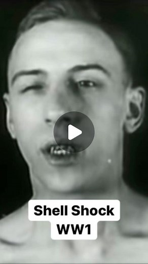 History Everyday | WW1 soldier suffering from shell shock. Follow @historyfromeveryday for daily historical content. #shellshock #ptsd #ww1 #veteran... | Instagram