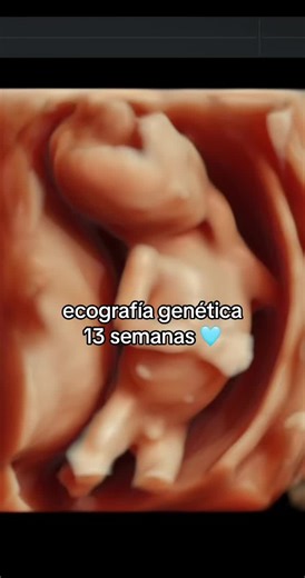 Ecografía de 13 Semanas: Cómo Se Ve un Bebé