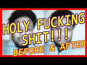 Total Life changes HCG Resolution no 20 drops testimonial 2015 tlc review reviews scam pyramid schem