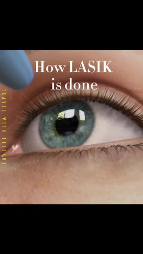 Understanding the Lasik Procedure: A Step-by-Step Guide