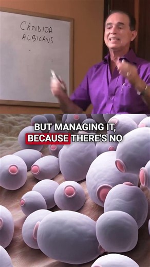 Candida Out of Control? Do This First!