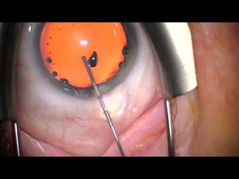 2025 10 08 181613 Panoptix Pro