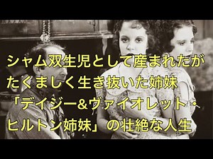 シャム双生児の壮絶な人生「デイジー&ヴァイオレット姉妹」#フリークス