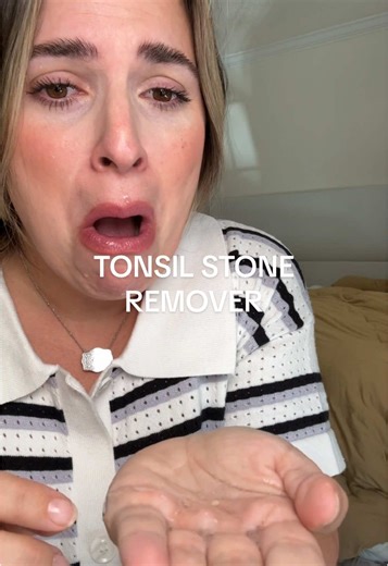 Revolutionary Water Flosser for Tonsil Stones Removal