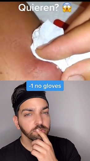 #doctorly #dermatologist #skincare #hairsplinter #barber | Doctorly