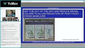 Calcaneal Fractures - My Practical Approach