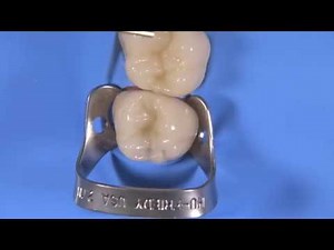 Rubber Dam Step By Step • Video • MEDtube.net