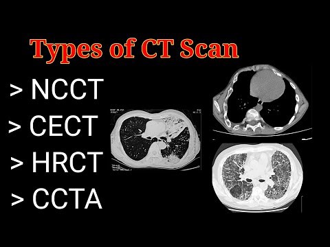 Types of CT Scan # NCCT # CECT # HRCT # CCTA # || By BL Kumawat #