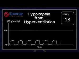 Waveform Capnography - Hypocapnia