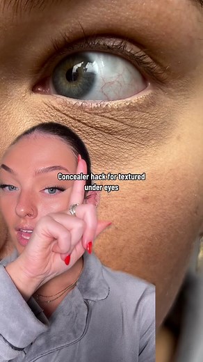 Tips to Stop Under Eye from Looking Dry and Creasing