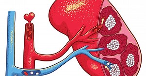 Pra que serve o baço?