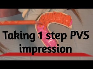 Taking a single step PVS impression (step by step guide)