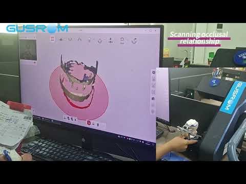 How to: Tips for Full-Arch Scanning 🦷