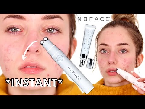 NuFace Fix Line Smoothing Device Review - What Is Microcurrent? *INSTANT RESULTS*