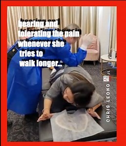 25M views · 413K reactions | She has been suffering from hips and...