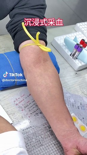 Master Quick and Painless Blood Draw Techniques