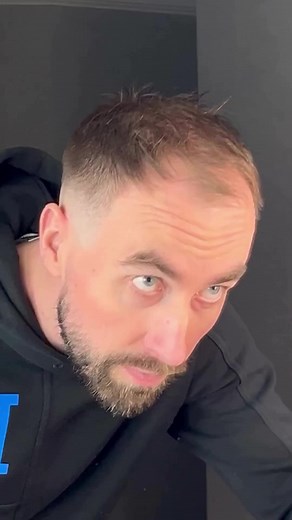 🌟 Unleash Your Hair’s Full Potential with THICK FIBER! 🌟 Tired of dealing with thin, lifeless hair? Look no further! Experience the incredible transformation that THICK FIBER offers today! 💆‍♀️✨ Say farewell to flat, lackluster locks, and welcome the newfound confidence of voluminous, luscious hair! 🙌 Available @amazon Don’t let your hair hold you back any longer - try THICK FIBER now and witness the instant boost! 💫 Embrace the beauty of thick, full hair and rock any style you desire! 💁‍♀