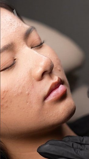 How to check your capillary refill