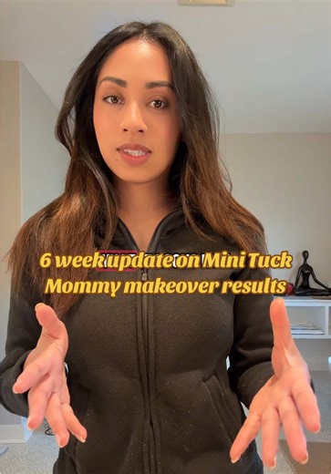 6 week update on Mini mini Tuck aka DriTuck and revealing my belly button results! #diastasisrecti #diastasisrectiexercises #tummytuck #mommymakeover
