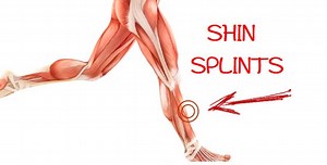 How to Prevent Shin Splints in Runners