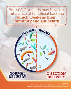 1.8K reactions · 22 shares | Hey moms, did you know that 4 out of 10 Filipino kids are born via C-Section?​ Turns out, CS-Born kids need extra support for their development. Good thing there's NEW Enfagrow A+ CS-Biome that is specially designed to help give STRONGER PROTECTION for CS-Born Kids (vs regular cow's milk and vs. formula w/o MFGM) for their A+ FUTURE (with proper nutrition and stimulation). ASC Ref. Code M0108P010625E | Enfagrow A+ Four Nurapro Philippines | Facebook