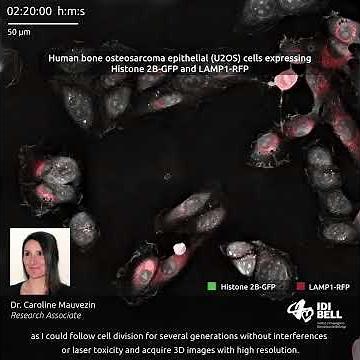 Human bone osteosarcoma epithelial cells (U2OS) expressing Histone 2B-GFP and LAMP1-RFP