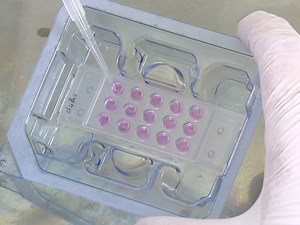 Dissection and Explant Culture of Murine Allantois for the In Vitro Analysis of Allantoic Attachment