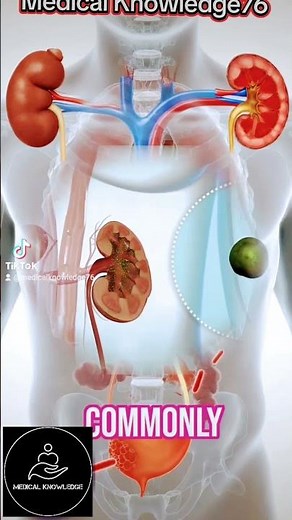 Pyelonephritis the Dangerous Path of Kidney Infection.