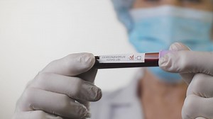 Coronavirus test in the hands of a doctor - Free Stock Video