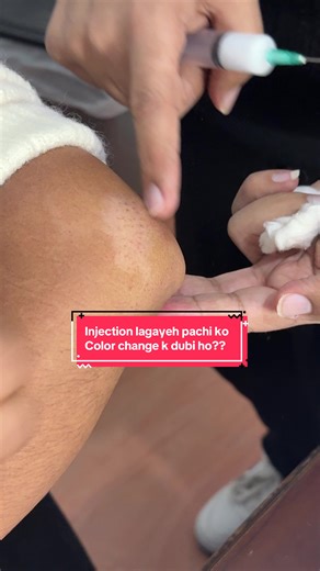 Injection lagayeh pachi ko color change k seeto dubi?