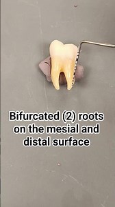 Dental Anatomy Review Tooth# 18