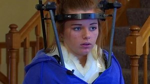 Teen breaks neck on homemade zipline in Big Lake, Minn.