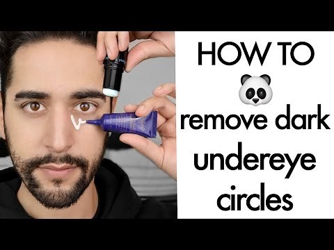 How To Remove Dark Circles And Bags Under Eyes ( tips and tricks) ✖ James Welsh