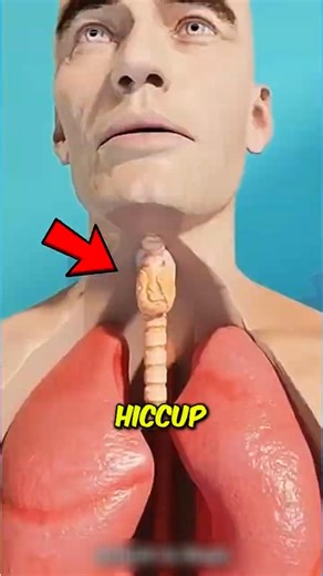 This Is Why Hiccups Make That Sound