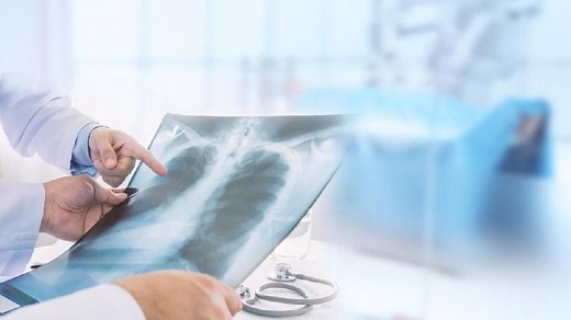 10 Jenis Infeksi Paru-paru, Gejala, Penyebab, dan Penanganannya