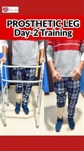 Day - 2 Training Artificial leg #artificialleg #fypp #foryou #shortsfeed #ytshorts #yt #naklitang