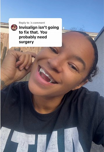 Understanding Invisalign: Benefits and Process Explained