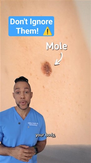 Don't ignore your moles!