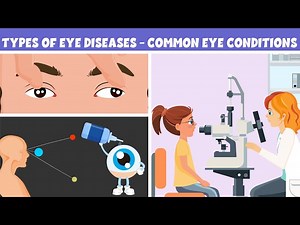 Types of Eye Diseases - Common Eye Conditions - Learning Junction Video - Videos For Kids