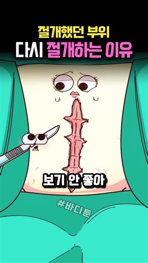 보기 흉한 흉터 제거 수술 방법