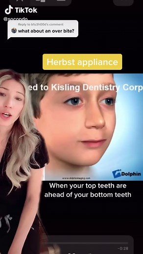 Understanding the Herbst Appliance and its Importance in Orthodontics