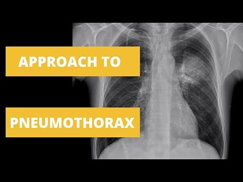 Approach to Pneumothorax - How to Read a Chest X Ray