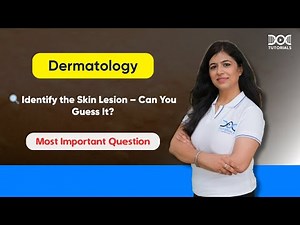 Identify the Skin Lesion | Wheal in Urticaria Explained | Dermatology Image-Based MCQ | FMGE V5