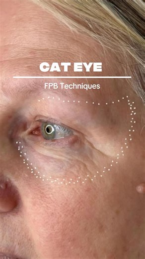 Janie Welsh on Instagram: "Cat Eye 👁️ . Lifting eyes with fibroblast you need to understand the importance of technique, pressure of your hands, the energy, and what works for each eye type. . In my online course and in person training I go over these important details and how to create mastery in this field. . Comment “FBME “ for more exclusive patterns and valuable insights on this treatment. #fibroblast #skintightening #blepharoplasty"