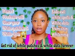 HOW TO GET RID OF WHITE PATCHES ON SKIN| Cure for White Dots| White Patches on Skin at Home Remedies