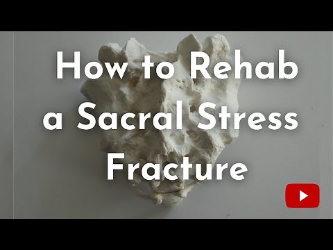 Sacral Stress Fractures| Causes, Diagnosis, & Treatment
