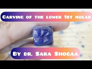 Carving of the lower 1st molar ( part 2) by Dr. Sara Shogaa
