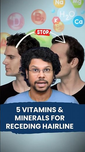 5 Vitamins, 4 Minerals for Receding Hairline | Hair Loss | Hair Regrowth Tips | Hair Expert | Waidon